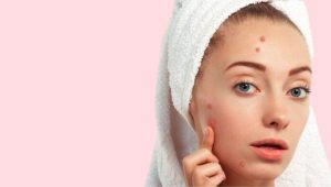 Facial Wash untuk Kulit Berjerawat