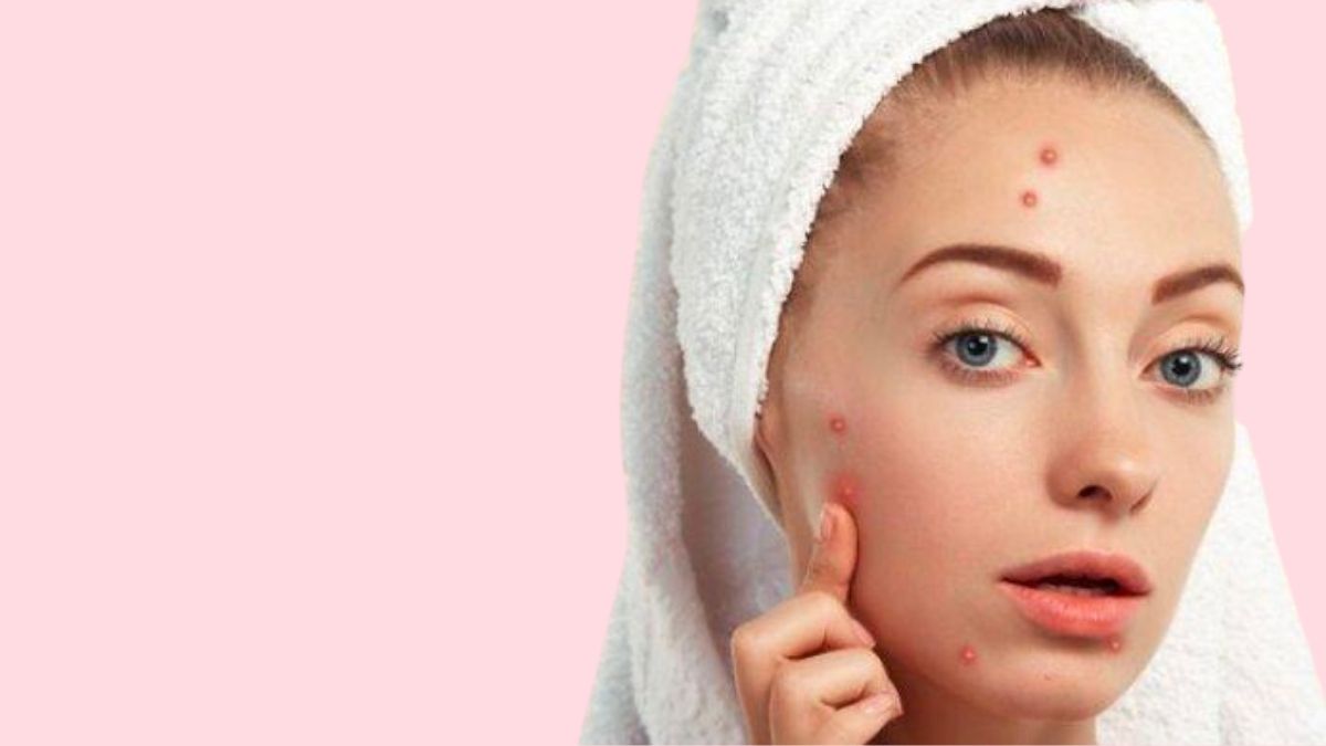 Facial Wash untuk Kulit Berjerawat