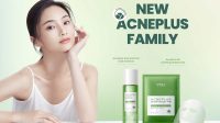 Acne YOU Beauty